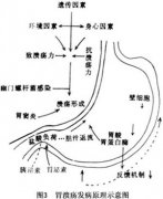 胃溃疡久治不愈：警惕胃癌